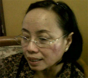 KUOTA JAMKESDA KAB. BLITAR 2013, COVER 9.000 LEBIH GAKIN