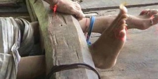 ORANG DENGAN GANGGUAN JIWA YANG DI PASUNG DIKABUPATEN BLITAR TERUS BERKURANG