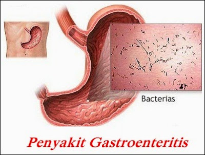 DINAS KESEHATAN SEBUT, KEMATIAN SATU BALITA ASAL DESA DARUNGAN KADEMANGAN BUKAN DISEBABKAN IMUNISASI MR